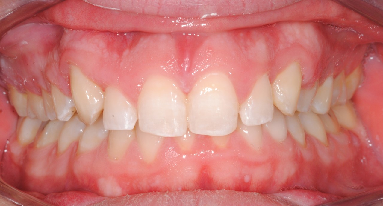Traitement orthodontique dentalam france